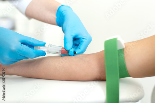 a gloved nurse inserts a needle into a vein on the patient arm and draws blood into a vacuum container. Blood sampling procedure