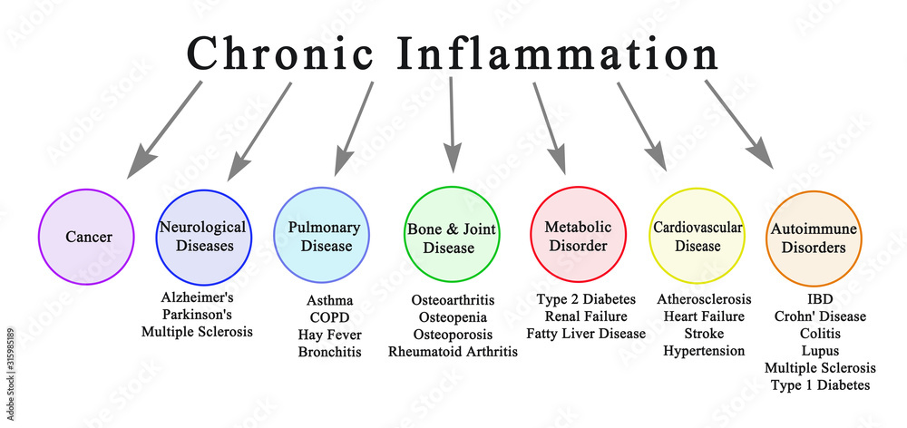Seven Consequences of Chronic Inflammation - obrazy, fototapety, plakaty 
