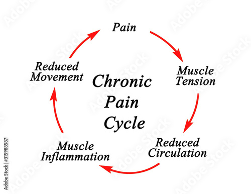 Steps in Chronic Pain Cycle
