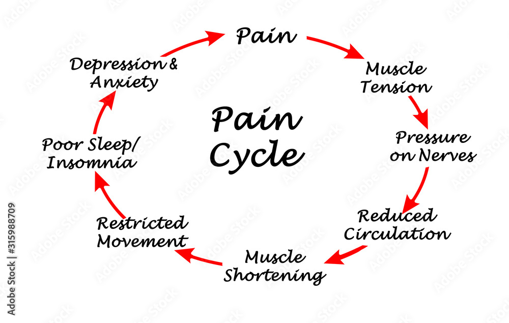 Eight Steps in Cycle of Pain