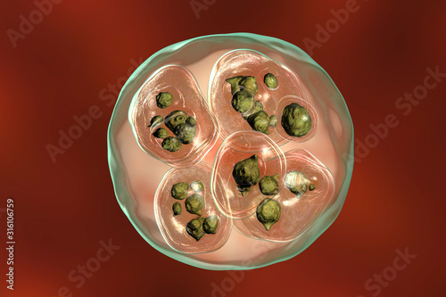 Hydatid cyst of Echinococcus multilocularis photo