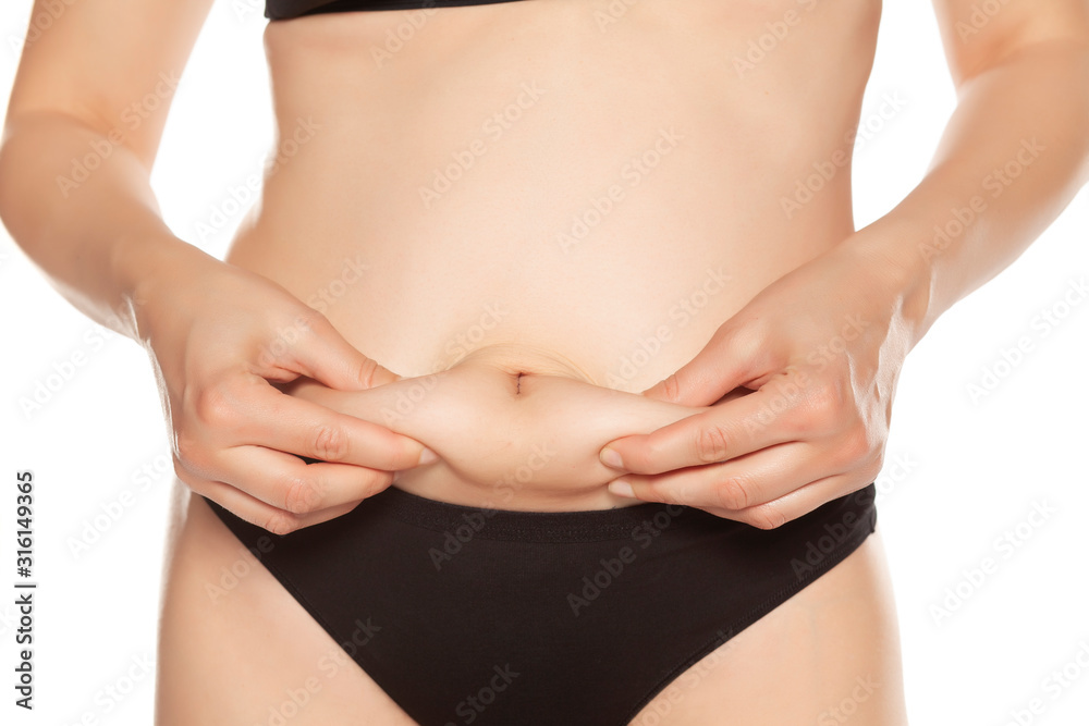 Woman pinching her belly fat