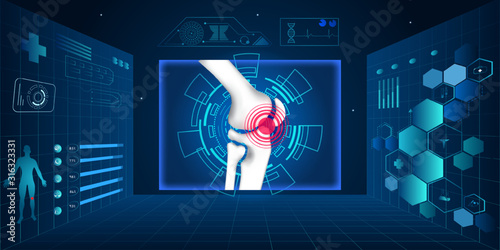 Treatment for knee osteoarthritis future medical scheme. Medications Administration with a syringe needle to damaged Joint and healthy Knee Anatomical.Vector illustration