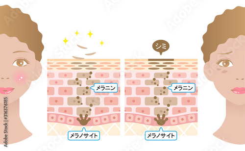ターンオーバー　肌の断面図と女性