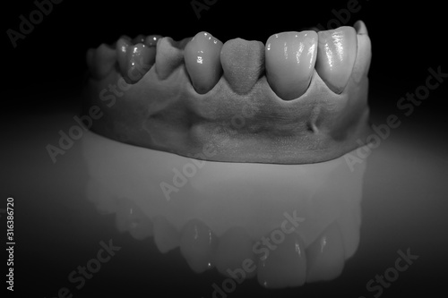 Ceramic teeth - Dental technician work