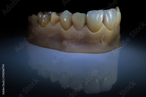 Ceramic teeth - Dental technician work photo