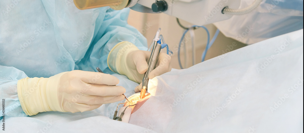 Fotografie Ophthalmology laser microscope operation