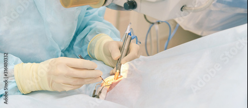 Foto Ophthalmology laser microscope operation