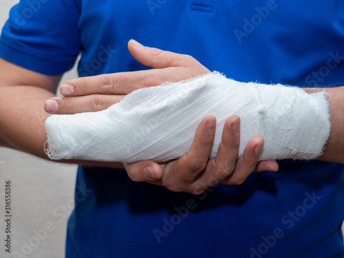 ..Close up hand of man with bandage and gypsum. a broken plastered arm after accident.