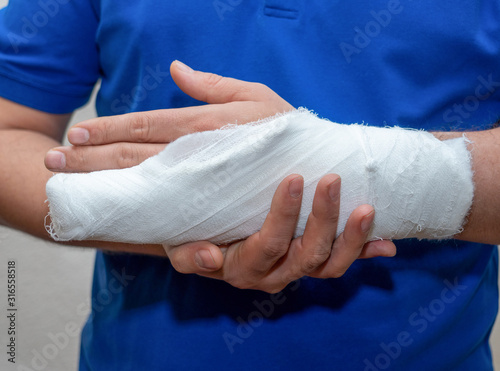 ..Close up hand of man with bandage and gypsum. a broken plastered arm after accident.