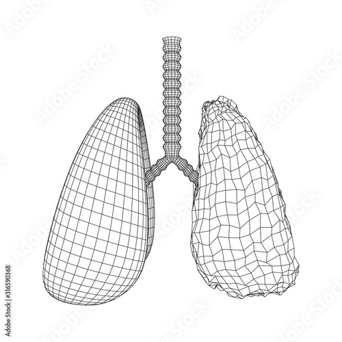 Healthy and sick lung with trachea bronchi internal organ human. Pulmonology medicine science technology concept. Wireframe low poly mesh vector illustration