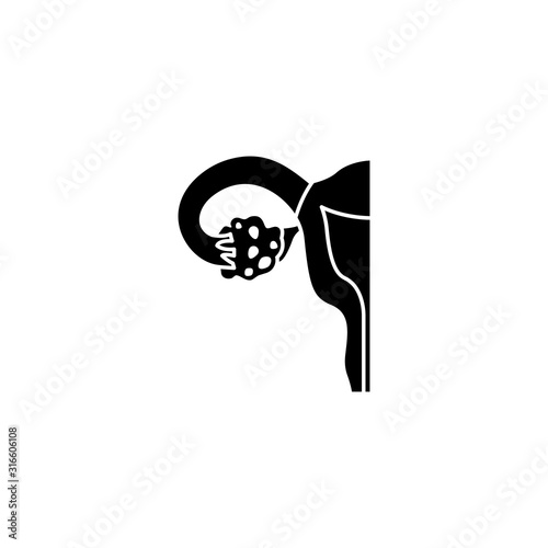 Ovulatory dysfunction icon. Simple gynaecology icons for ui and ux, website or mobile application