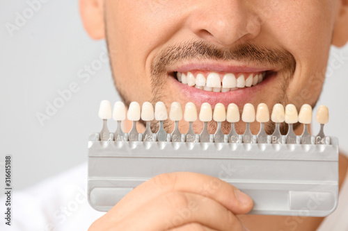 Man with teeth color samples on light background  closeup
