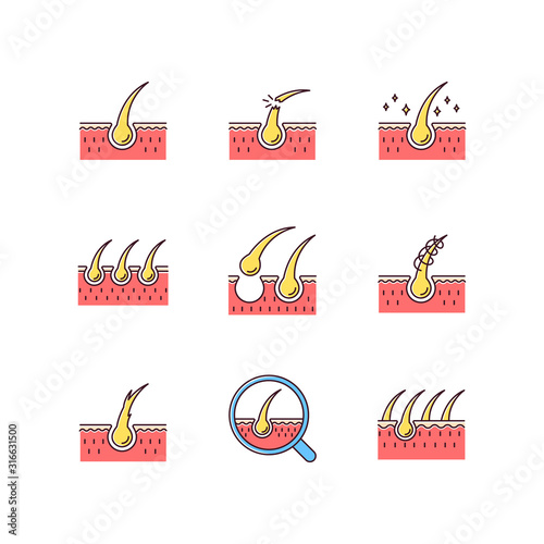 Hair loss RGB color icons set. Damaged hair, unhealthy roots. Scalp and follicle. Skin tissue. Dermatology treatment, haircare problem. Alopecia and balding. Isolated vector illustrations