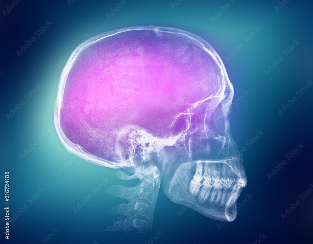 Human skull X-ray image Human skull X-ray image