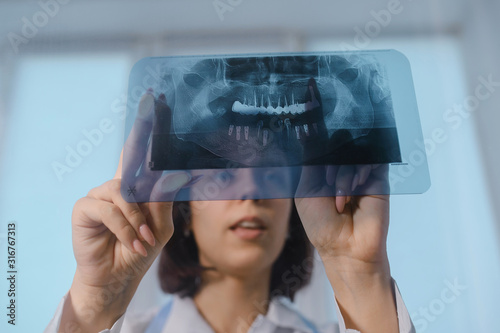 Close up picture of young woman doctor dentist who analysis dental x ray orthopantomogram. Dental panoramic radiography photo