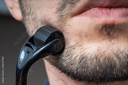 Facial hair care concept. Young man is using derma roller on beard. photo