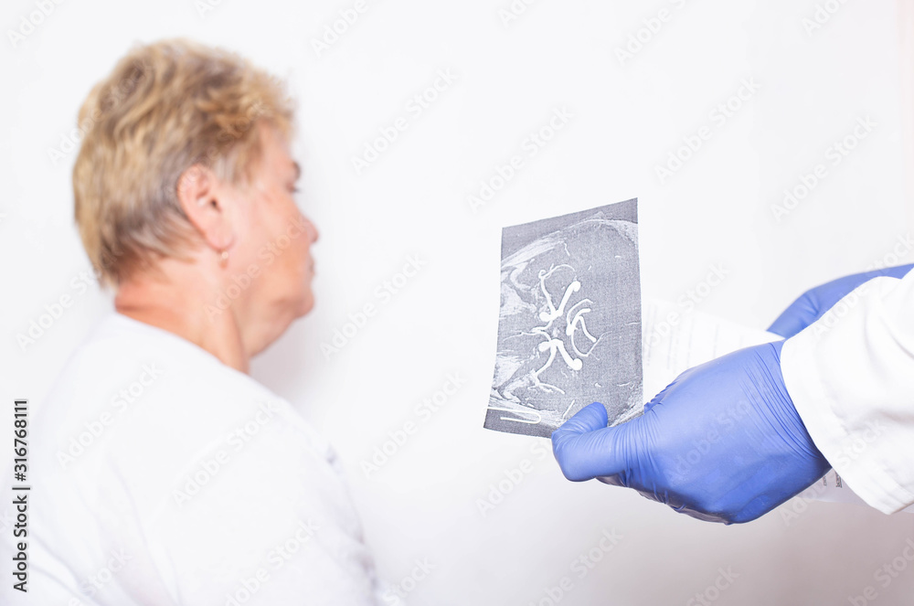The patient is an elderly woman with a headache at a doctor's appointment. The concept of cerebral arteriosclerosis, healthcare The patient is an elderly woman with a headache at a doctor's appointment. The concept of cerebral arteriosclerosis, healthcare