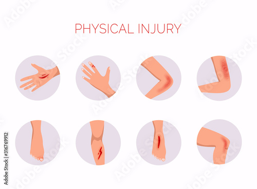 Human body physical injury round flat set. Open cut wounds and elbow bruise.
