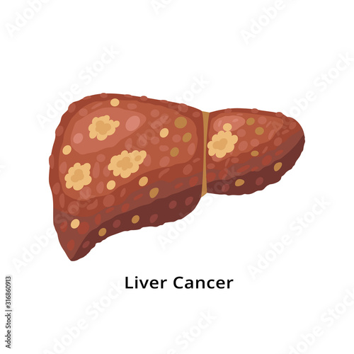 Liver cancer icon isolated on white background. Liver disease concept illustration in flat design.