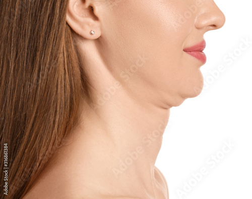 Obraz na plátne Young woman with double chin on white background