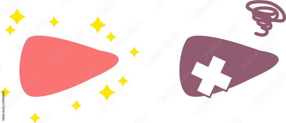 シンプルな健康 不健康な肝臓のイラスト 内臓 消化器 Stock Vector Adobe Stock