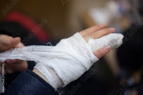 Applying a bandage to a broken finger. Fixing a broken finger for bone fusion. First aid for damage to the phalanx of the finger. Hand injury. The provision of medical care.