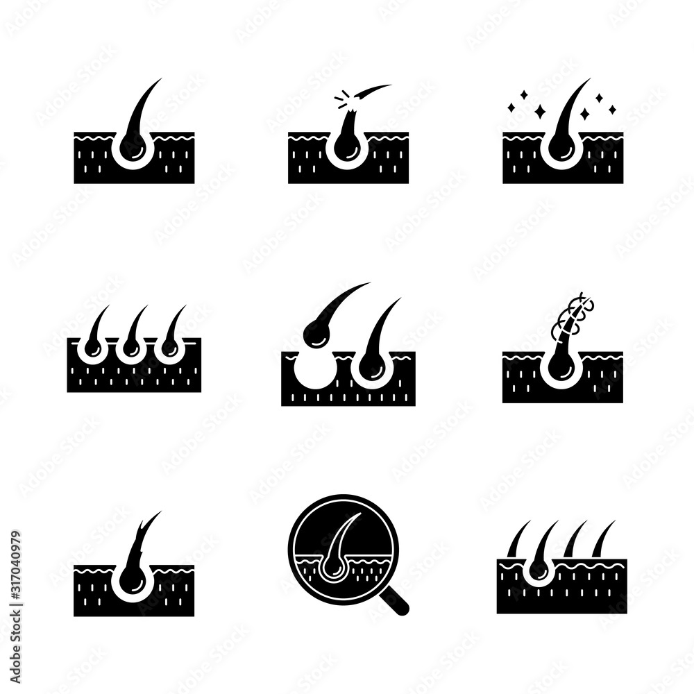 Hair loss black glyph icons set on white space. Damaged hair, unhealthy ...