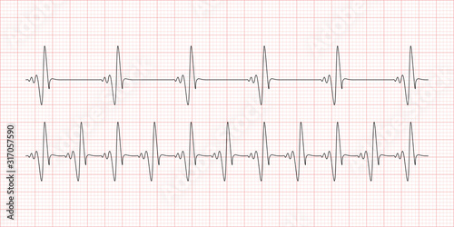 Cardiogram, heartbeat, Electrocardiogram with red mesh. Healthcare, life and heart examination concept. Vector illustration