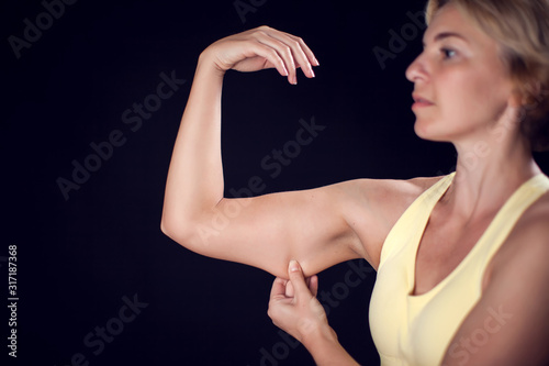 Woman in yellow sport top showing bad shape of triceps. Fitness and healthcare concept
