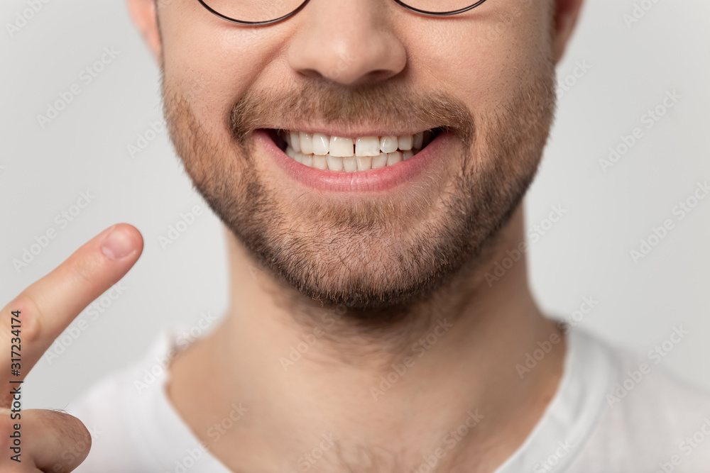 Obraz premium Close up cropped image man pointing finger to toothy smile.