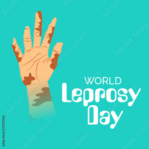World leprosy day. © Anup