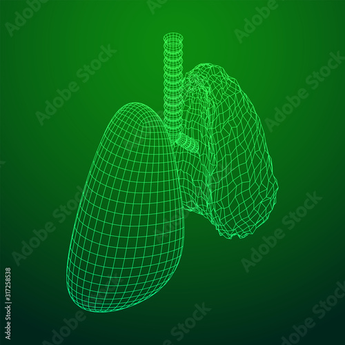 Healthy and sick lung with trachea bronchi internal organ human. Pulmonology medicine science technology concept. Wireframe low poly mesh vector illustration