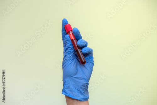 Medical worker in protective costume holding red test tubes in hands in laboratory