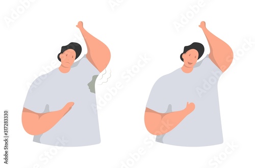 Wet armpits. Smelly, sweaty stains on male clothes. Hyperhidrosis people, sweat spots prevention. Vector flat illustration.