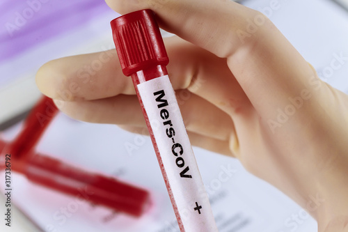 MERS-CoV blood test medical equipment one of several test tubes