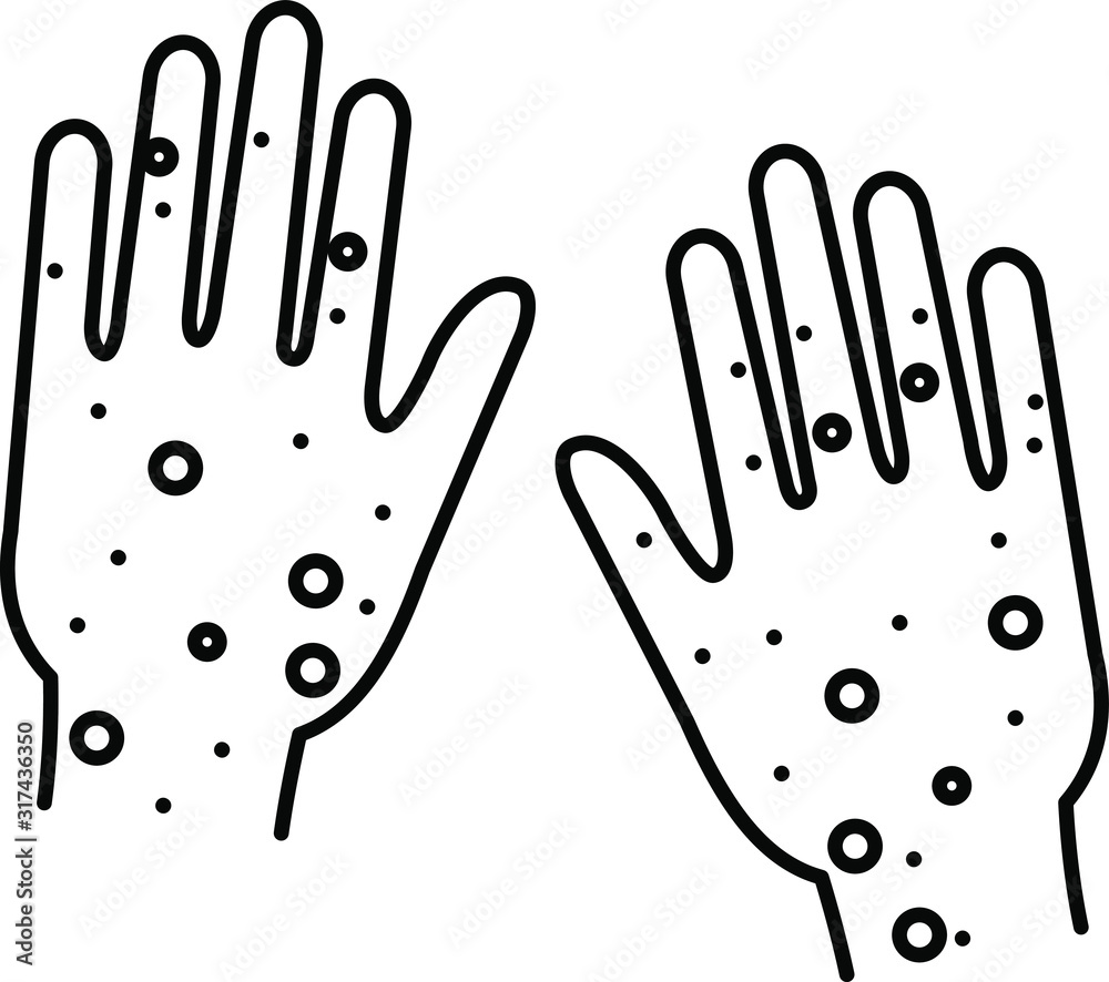 Obraz premium Rash hand icon.