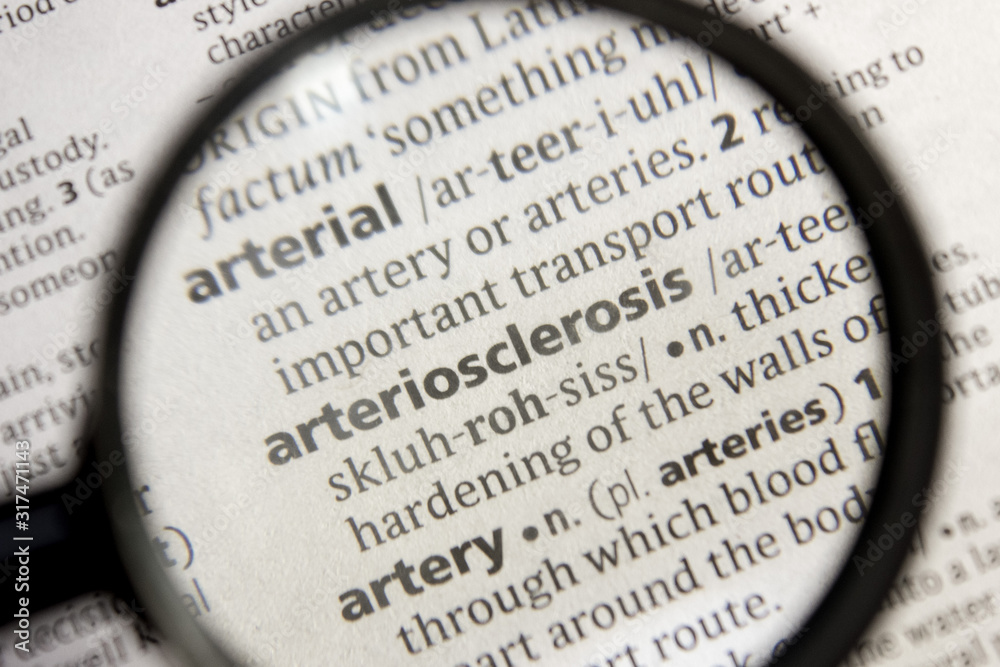Arteriosclerosis word or phrase in a dictionary. Arteriosclerosis word or phrase in a dictionary.