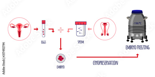 Cryo preservation of embryo. Egg and Sperm donation. Sperm banking. Embryo freezing. Vector illustration.