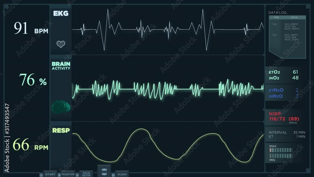 Animation of a fast electrocardiogram reading display.