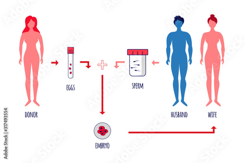 Egg donation. Scheme of egg donation procedure. One woman donates eggs to another woman and her husband. Embryo. IVF. Vector illustration.