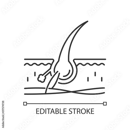 Follicle pixel perfect linear icon. Damaged hair root. Microscopic look on skin tissue. Thin line customizable illustration. Contour symbol. Vector isolated outline drawing. Editable stroke