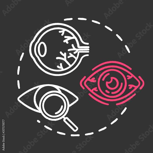 Ocular oncology chalk RGB color chalk RGB color concept icon. Eye neoplasm diagnosis. Structure, functioning of eye. Ophthalmology idea. Vector isolated chalkboard illustration on black background