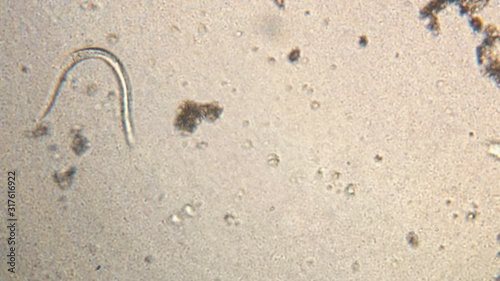 Microscopy of parasite worm nematode (Strongyloides stercoralis). Movement of active parasite infection form in magnification 150x. photo