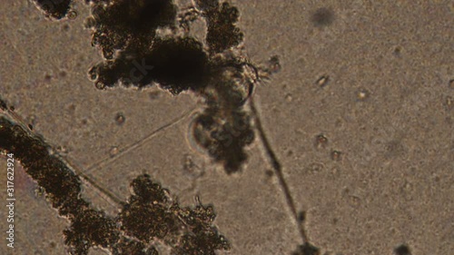 Microscopy of protozoa Vorticella in the water (pond) sample. Infusoria attached to the substrate and draws water with bacteria. Magnification 300x movement of cilia on the front of body.