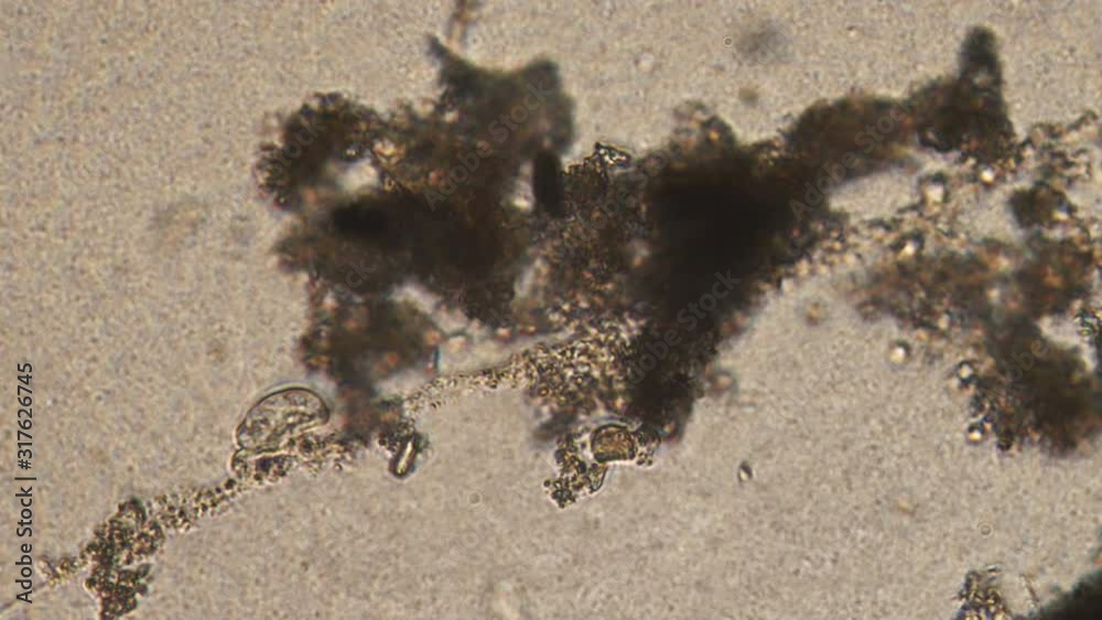 Microlaria Microscope Microscopy of protozoa ciliate and small microorganisms in the water ...