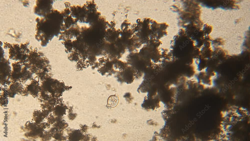 Microscopy of protozoa Vorticella in the water (pond) sample. Infusoria ...