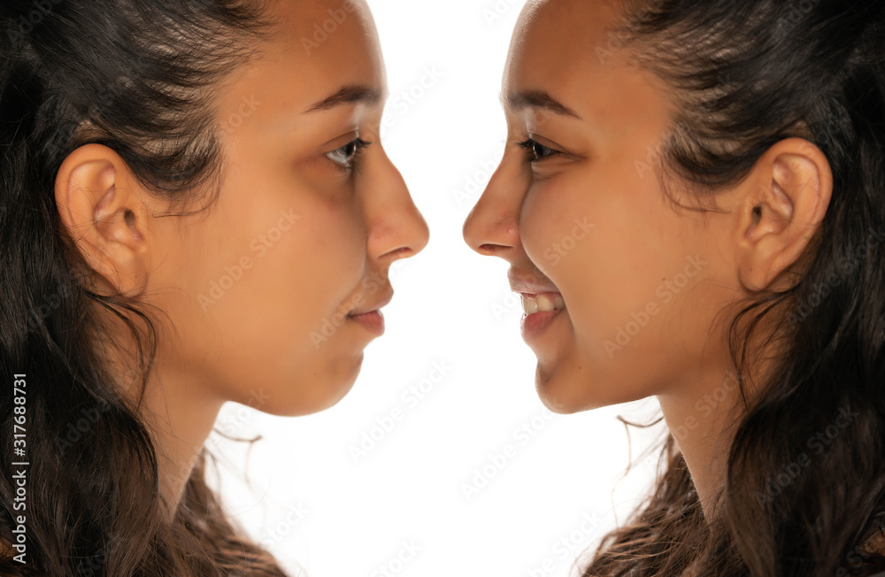 comparison portrait of young latin woman before and after nose job comparison portrait of young latin woman before and after nose job