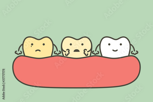 yellow to white tooth, teeth whitening before and after concept - dental cartoon vector flat style