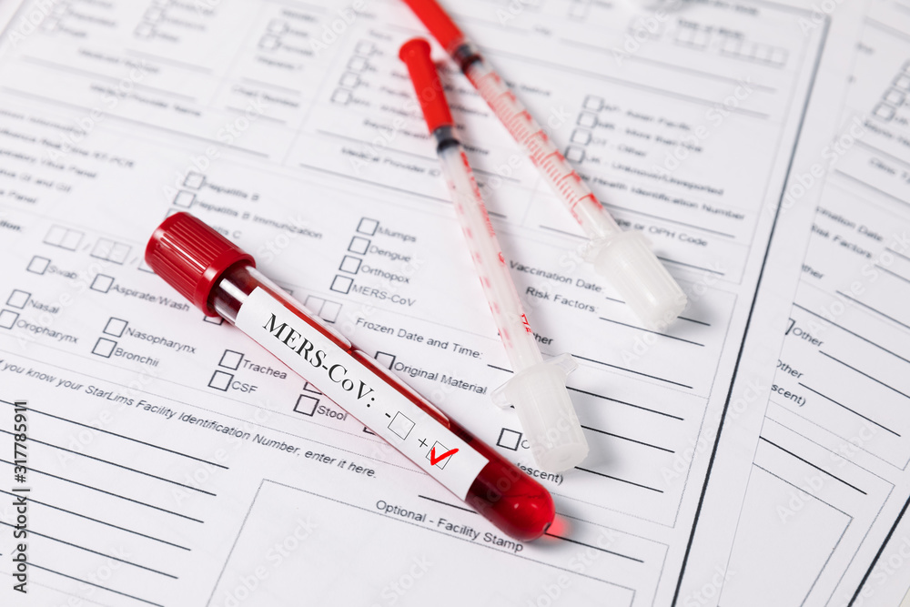 Test tubes with blood. nCov, Coronavirus test Test tubes with blood. nCov, Coronavirus test